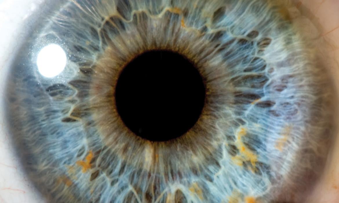 iridology images (19)
