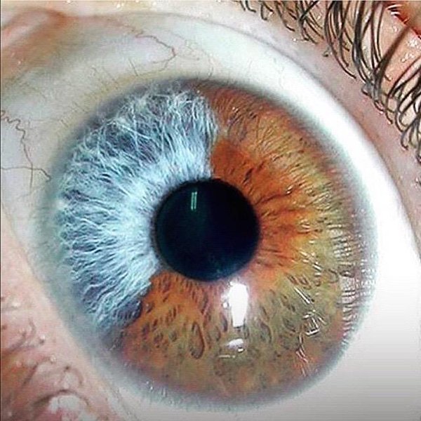 iridologia 3 Primer plano detallado de un iris humano mostrando las fibras nerviosas y patrones de color utilizados en iridología