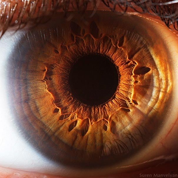 iridology images