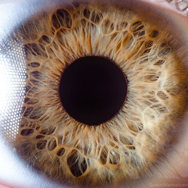 iridology images
