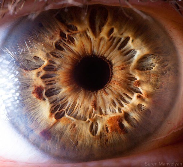 iridology images