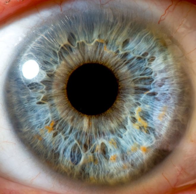 iridology images