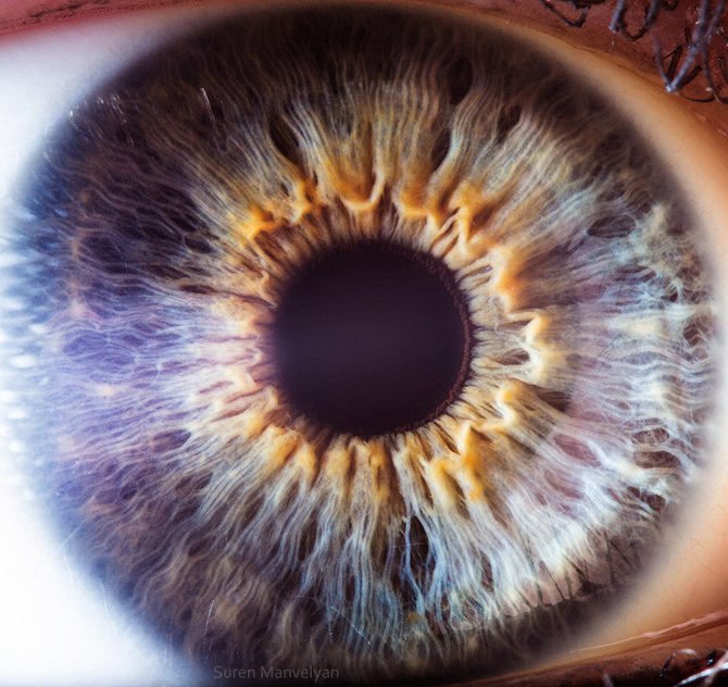 iridology images