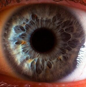iridology images