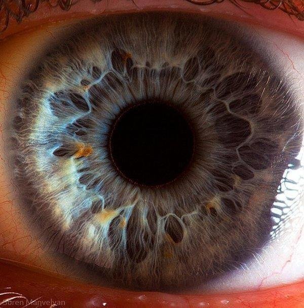 iridology images