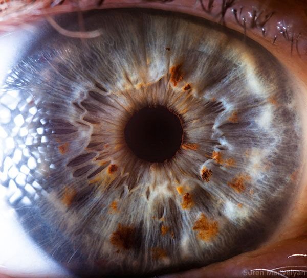 iridology images