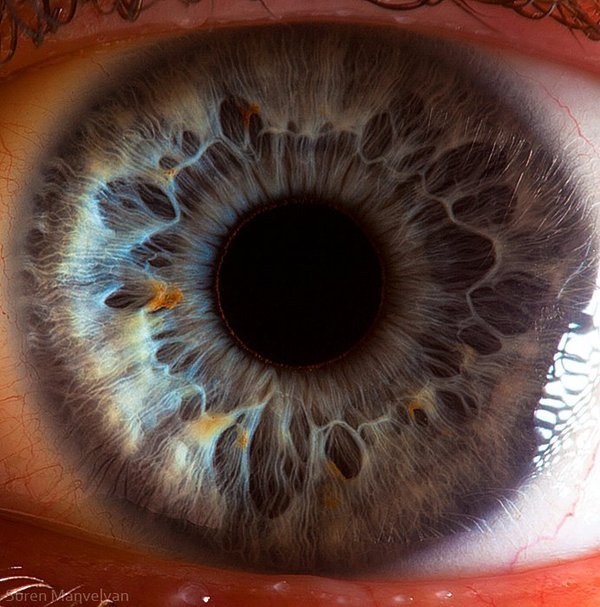iridology brown eyes