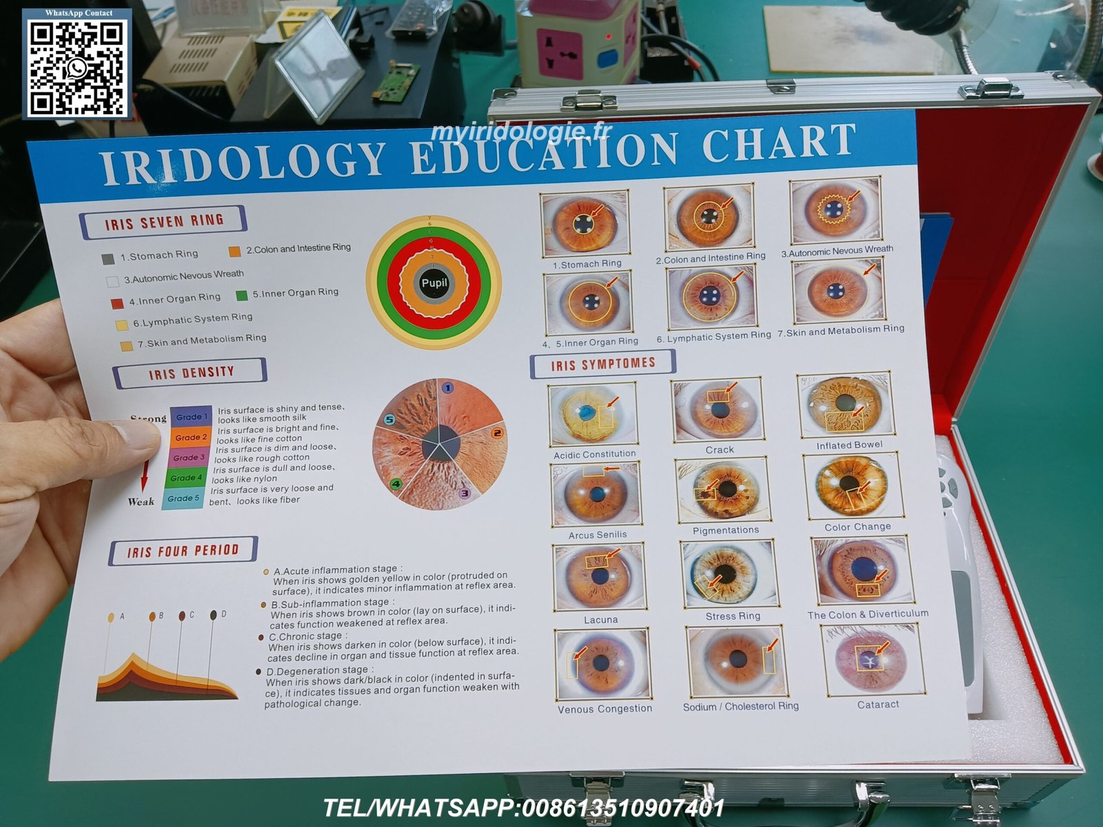 Muestras gratuitas de mapas iridologicos profesionales