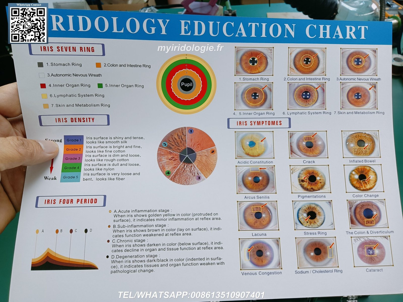 Muestras gratuitas de mapas iridologicos profesionales