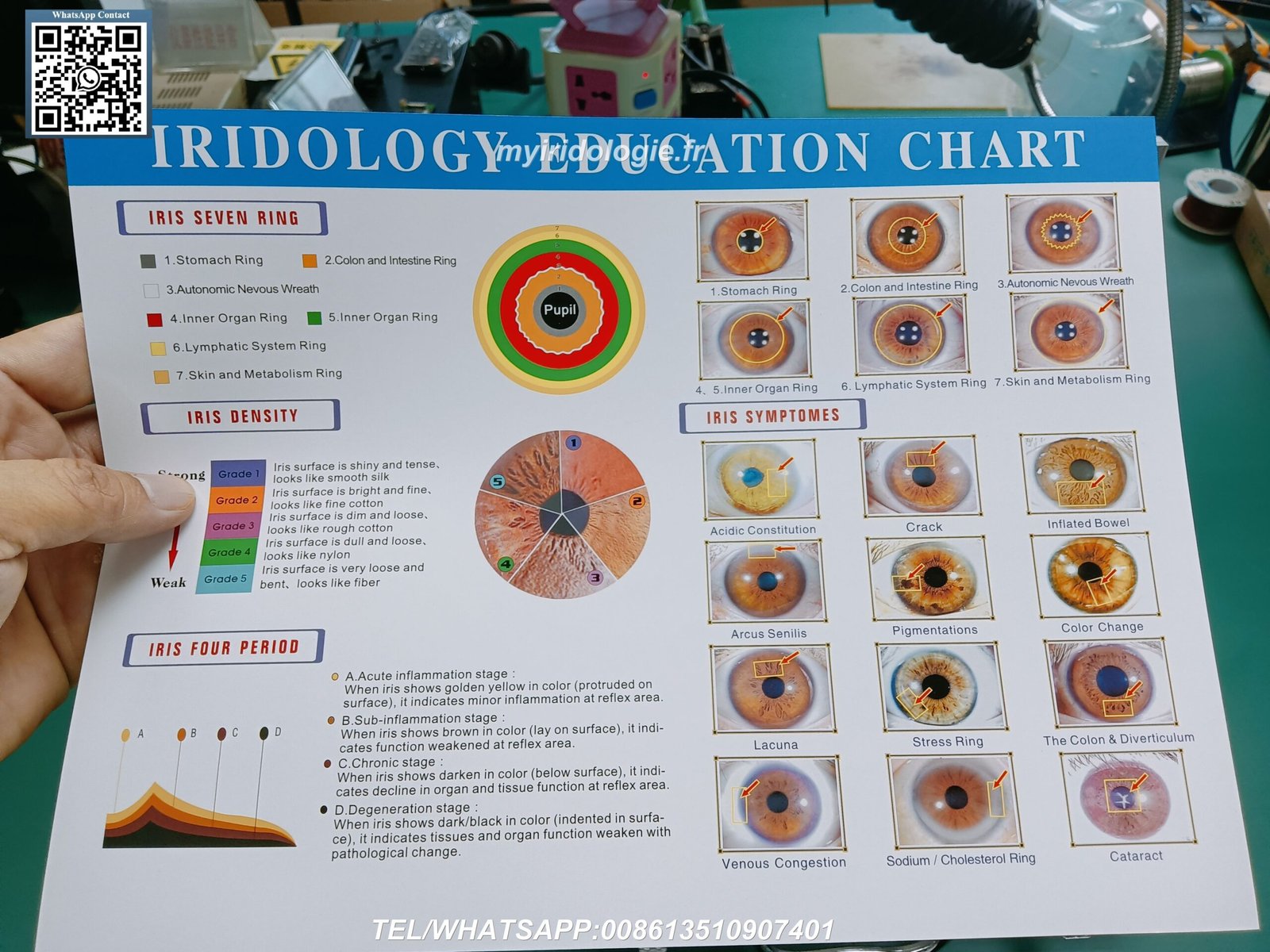 Iriscopio digital MAIKONG de 12 megapixeles para análisis profesional del iris