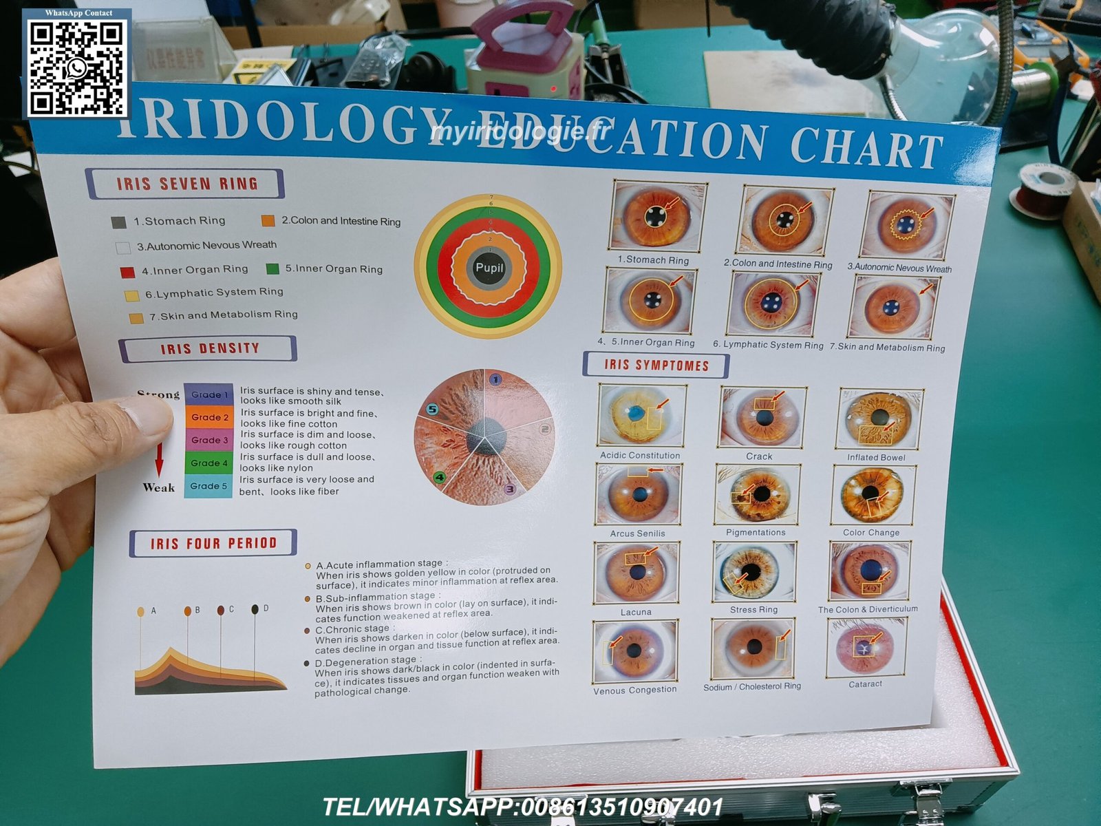 Cámara iridológica digital profesional de MAIKONG capturando imagen de alta resolución del iris