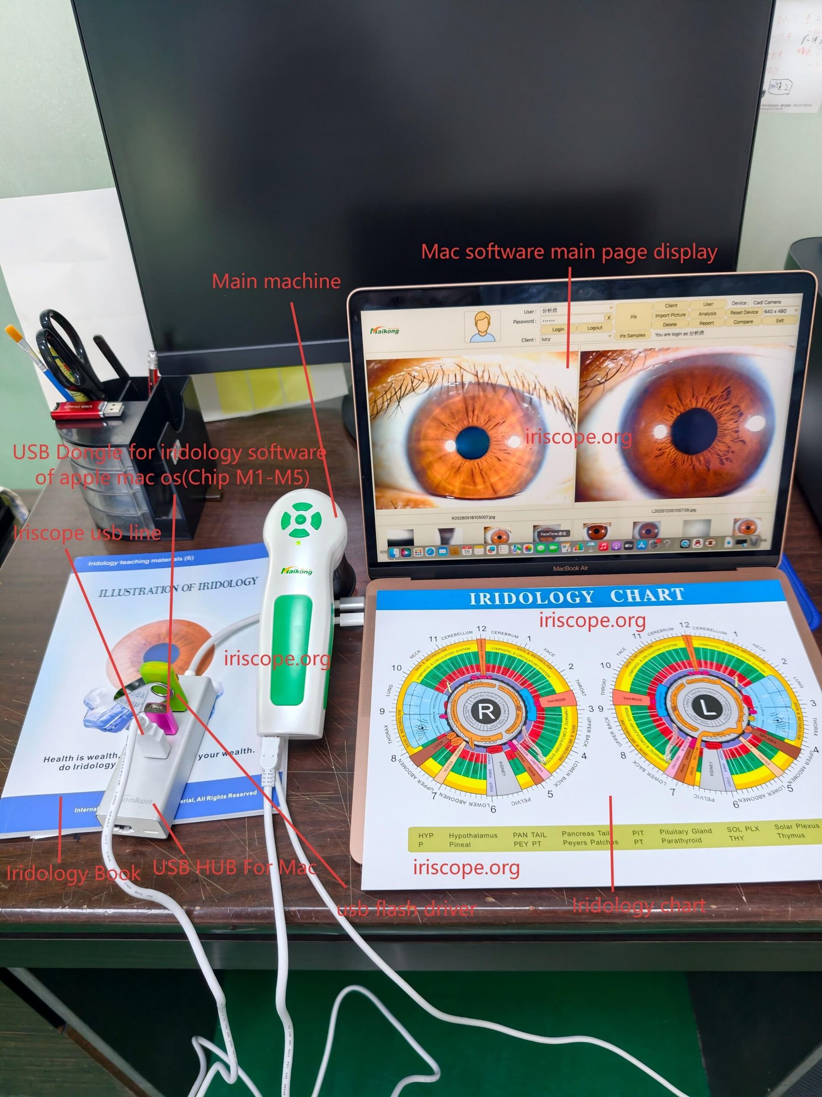 Configurar la cámara de iridología MAIKONG MK-9822U en Mac: guía práctica para consultor@s de salud en España — 9811 APPLE 带水印.jpg