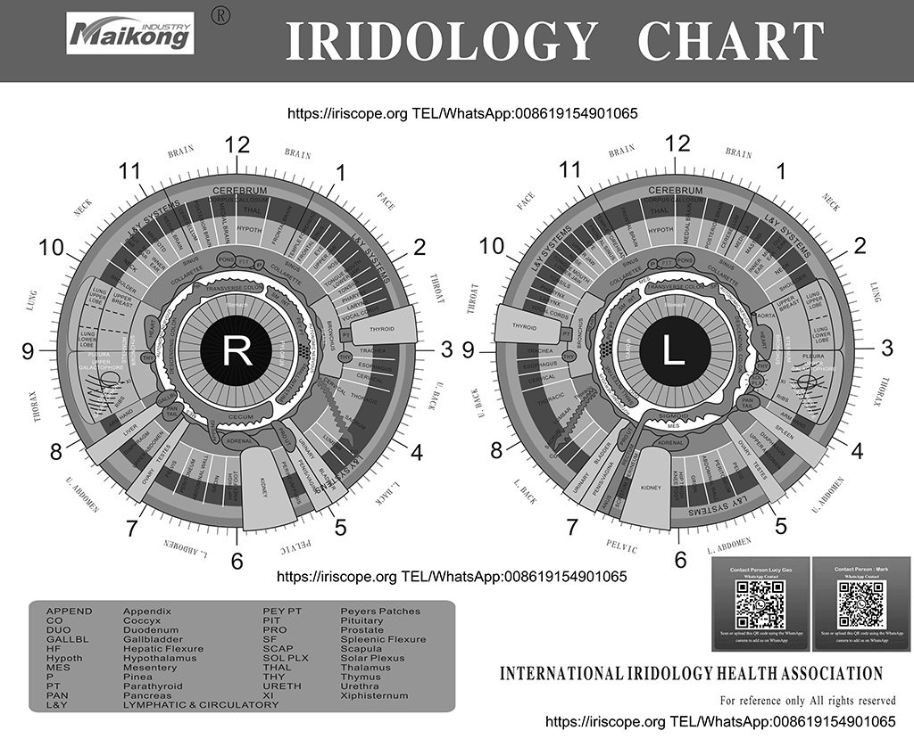 Mapa del iris del ojo: guía práctica para médicos de clínicas de naturopatía en España — MAIKONG iridologia mapa (2).jpg
