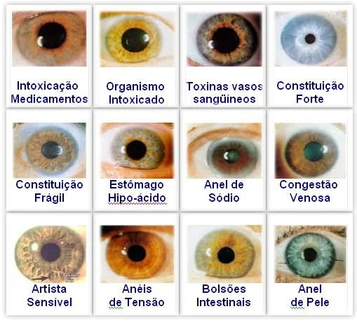 Estación fija para iridología en consulta: requisitos eléctricos y de red para instalar un iriscope — jensen iridology chart (5).jpg