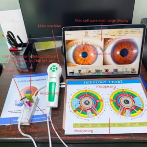 MAIKONG iriscope iriscopio iridology camera MK-0012 — _20260519113123_1165_5.jpg