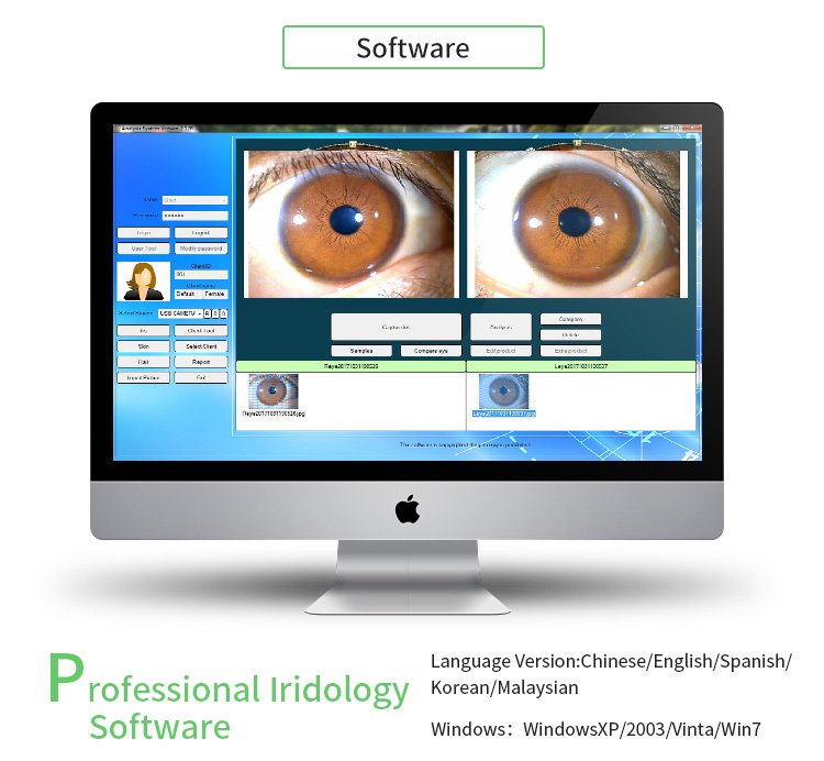 La guía práctica del iriscopio digital para tu consulta en España — appareil photo iridologie (18).jpg