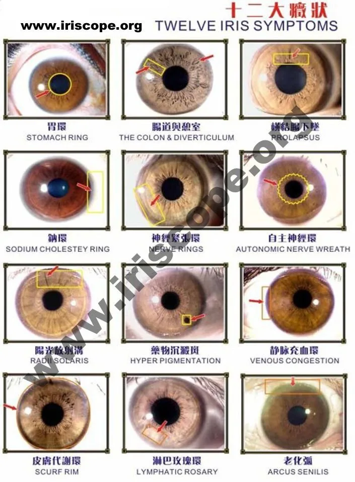 Estación fija para iridología en consulta: requisitos eléctricos y de red para instalar un iriscope — jensen iridology chart (4).jpg