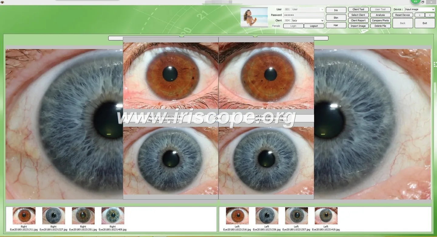 Ergonomía para iridología: cómo colocar paciente y operador para capturas rápidas y reproducibles — Software de Iridología (32).JPG