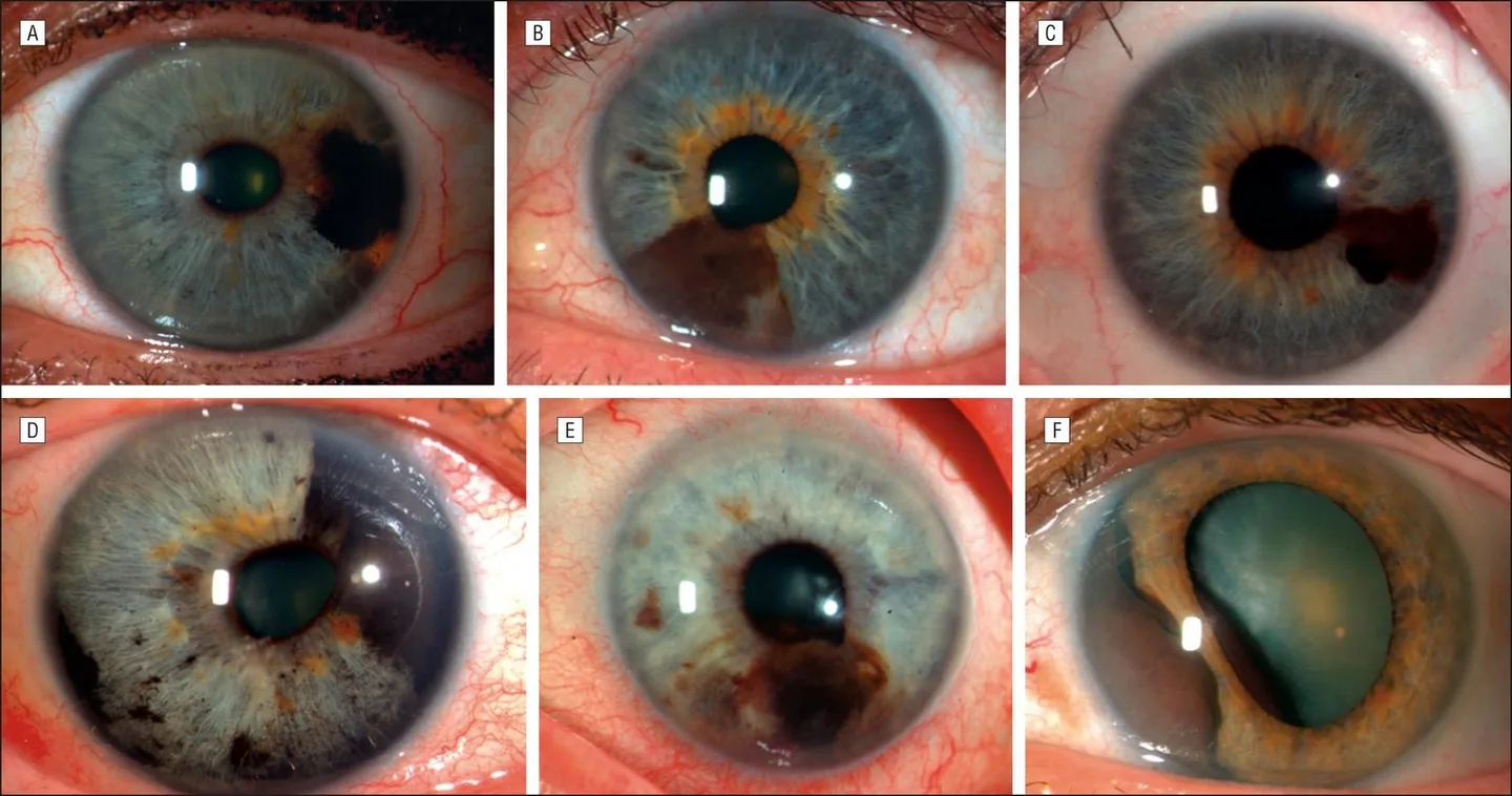 Ergonomía para iridología: cómo colocar paciente y operador para capturas rápidas y reproducibles — MAIKONG IRIDOLOGY CAMERA (2937).JPG