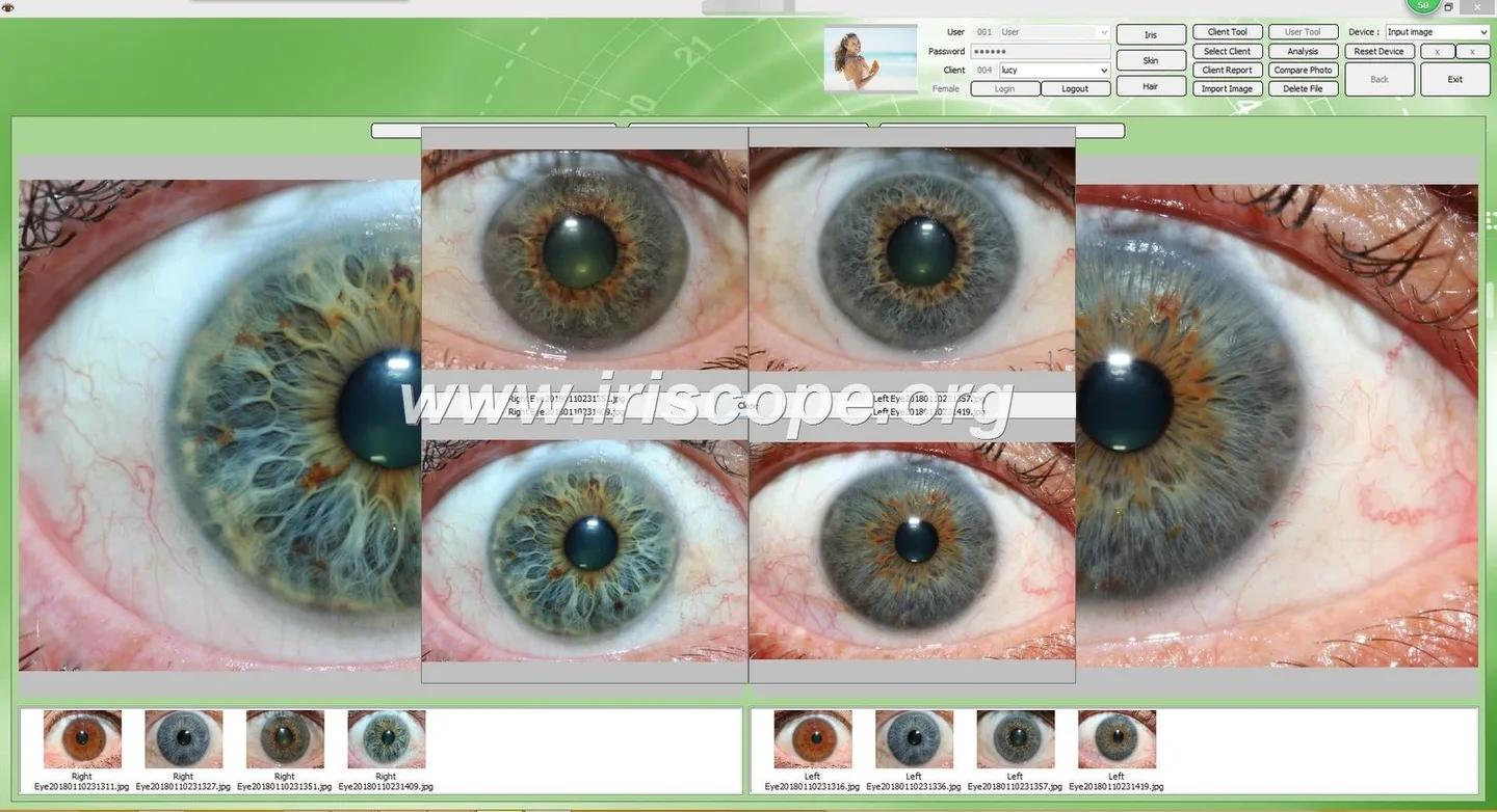 MAIKONG iriscope iriscopio iridology camera MK-0012 — Software de Iridología (33).JPG