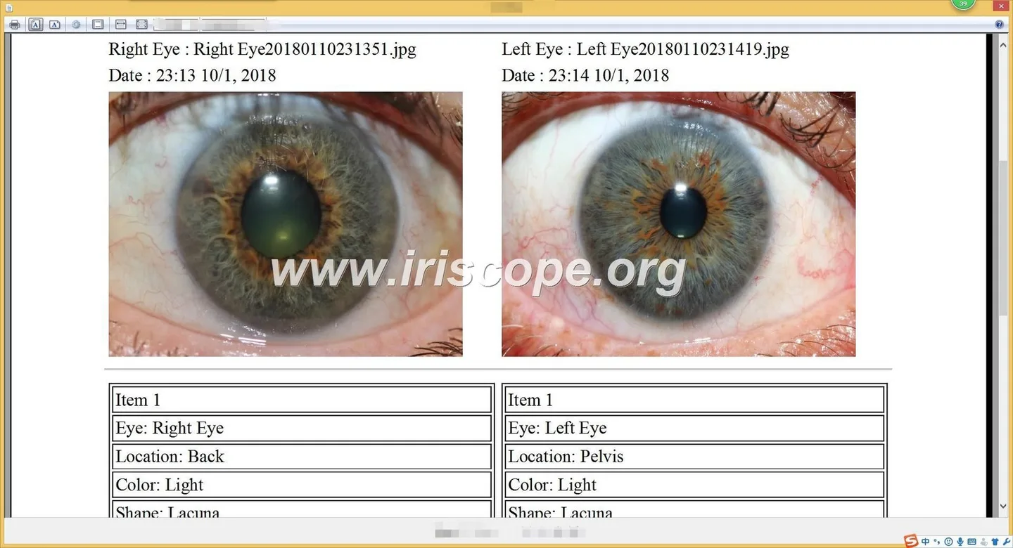 MAIKONG iriscope iriscopio iridology camera MK-0012 — Software de Iridología (51).JPG