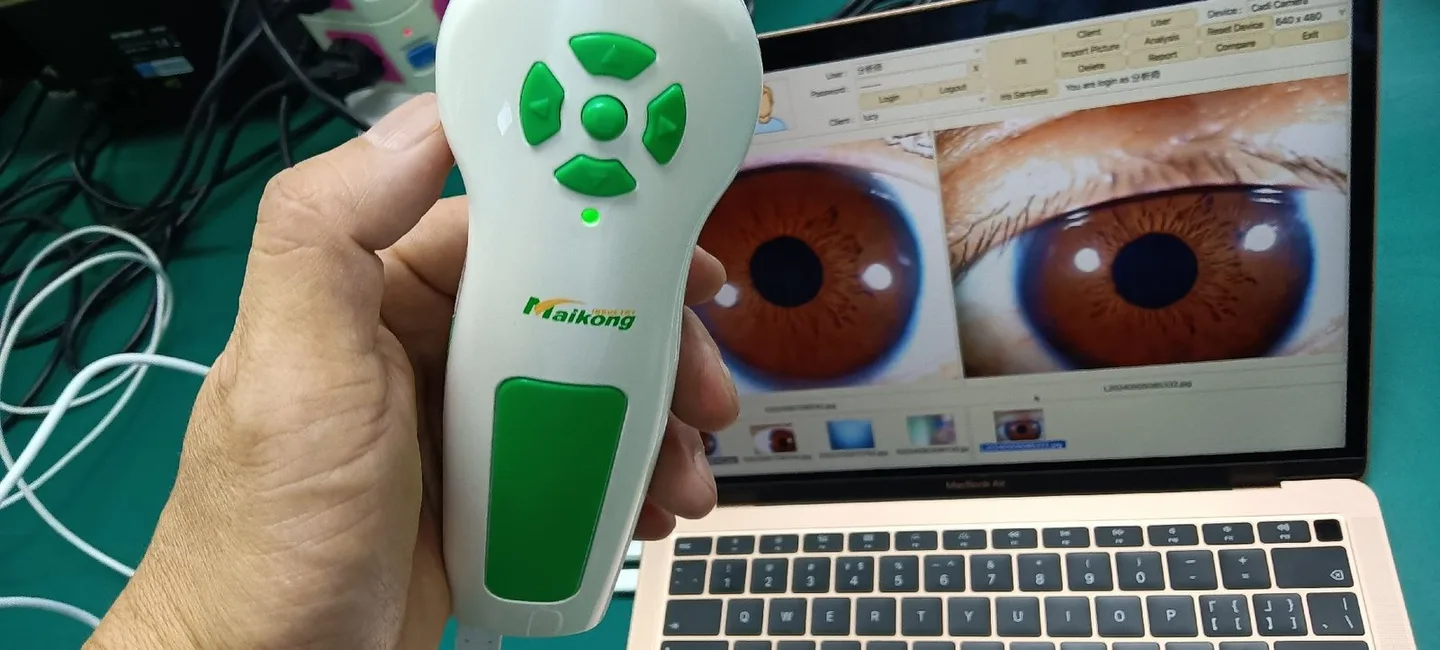 6 Questions To Ask Yourself Before You Iridology Camera Australia. &ndash; MAIKONG Iridology Camera - Iriscope-Leading Manufacturer — 056.JPG
