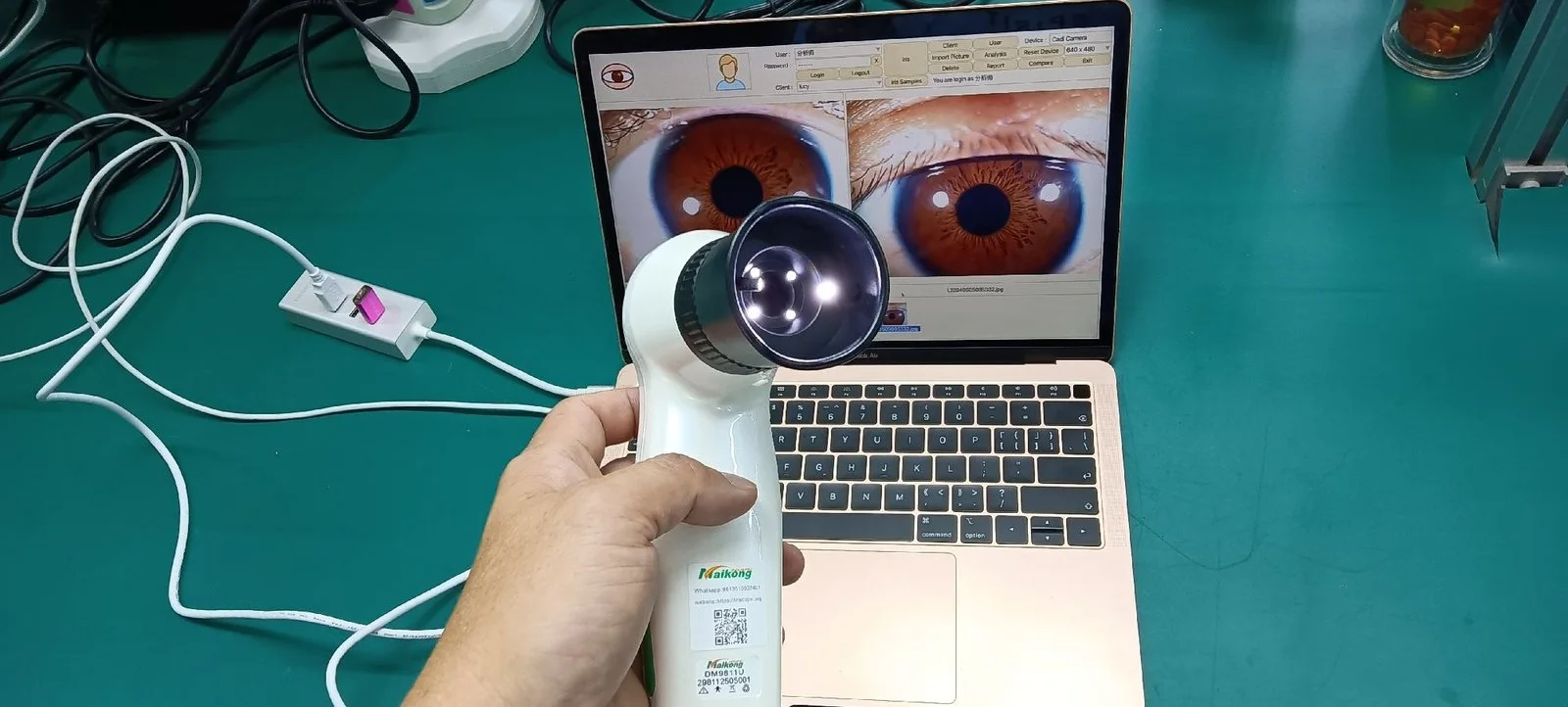 6 Questions To Ask Yourself Before You Iridology Camera Australia. &ndash; MAIKONG Iridology Camera - Iriscope-Leading Manufacturer — 009.JPG