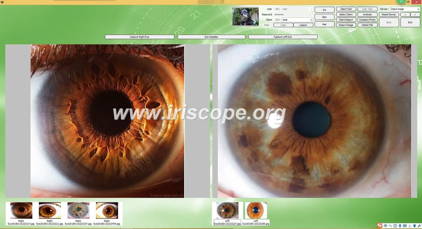 IrisExplorer v5.1 (IRISLAB): guía práctica para el profesional de salud independiente en España — Software de Iridología (55).JPG