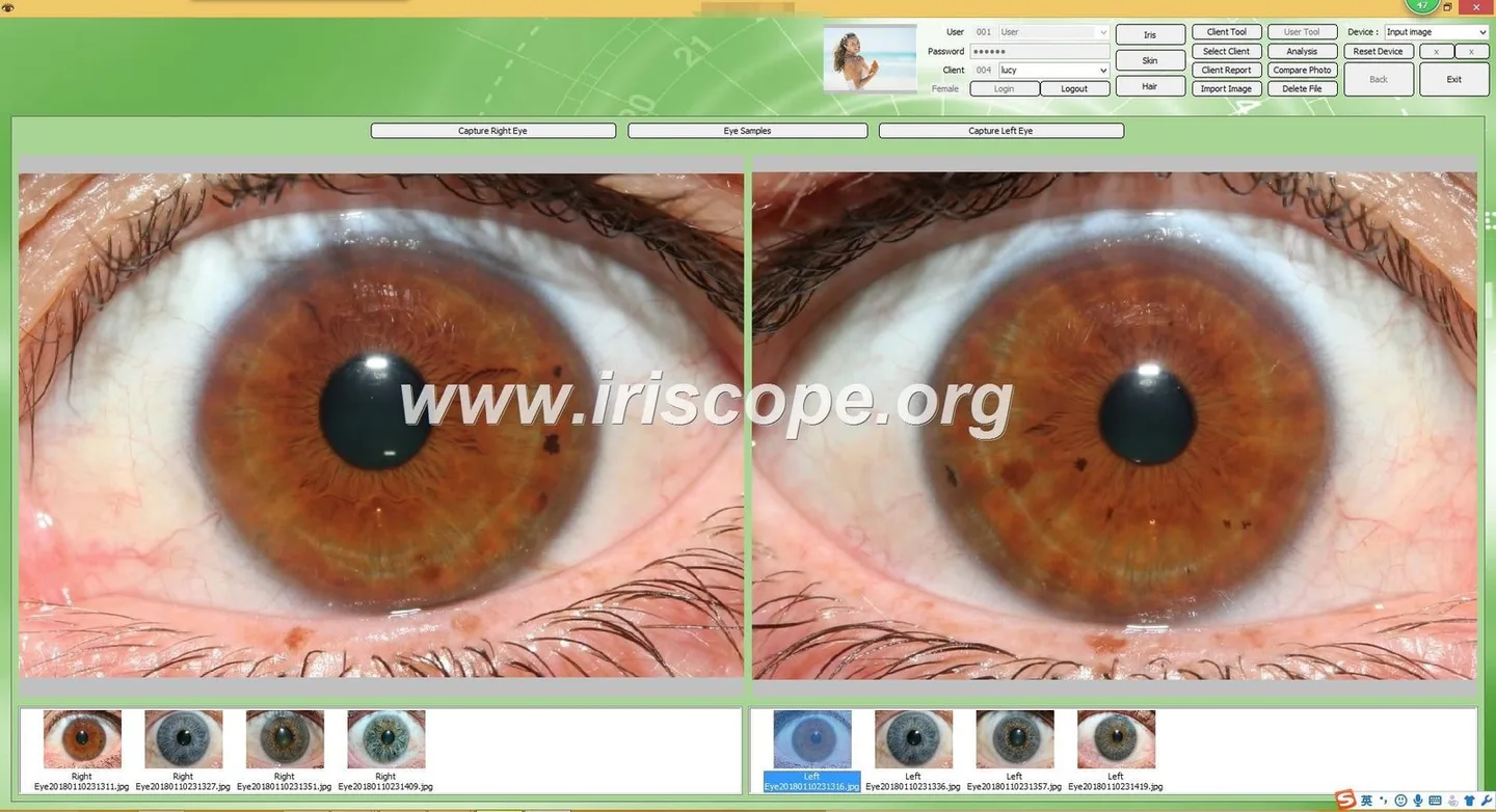 IrisExplorer v5.1 (IRISLAB): guía práctica para el profesional de salud independiente en España — Software de Iridología (29).JPG