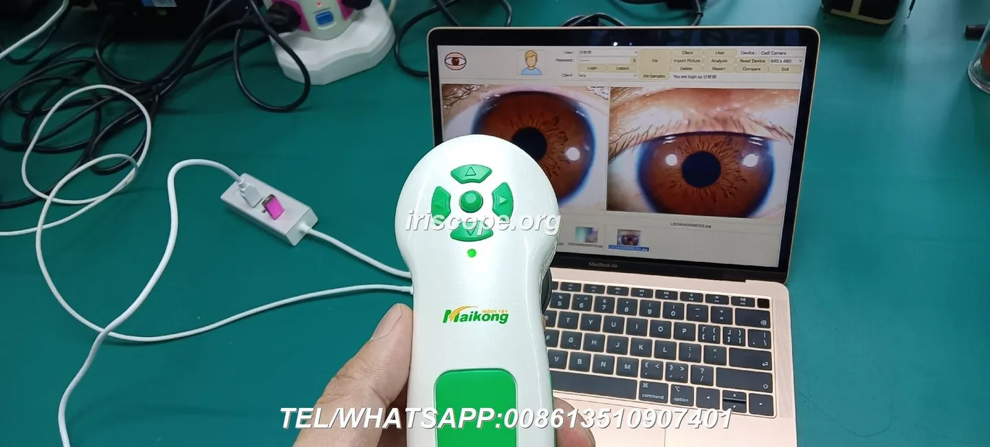 Opciones y alcance de personalización OEM/ODM para distribuidores MAIKONG en España — maikong iridology camera iriscope 12 mp for apple mac os (8).JPG
