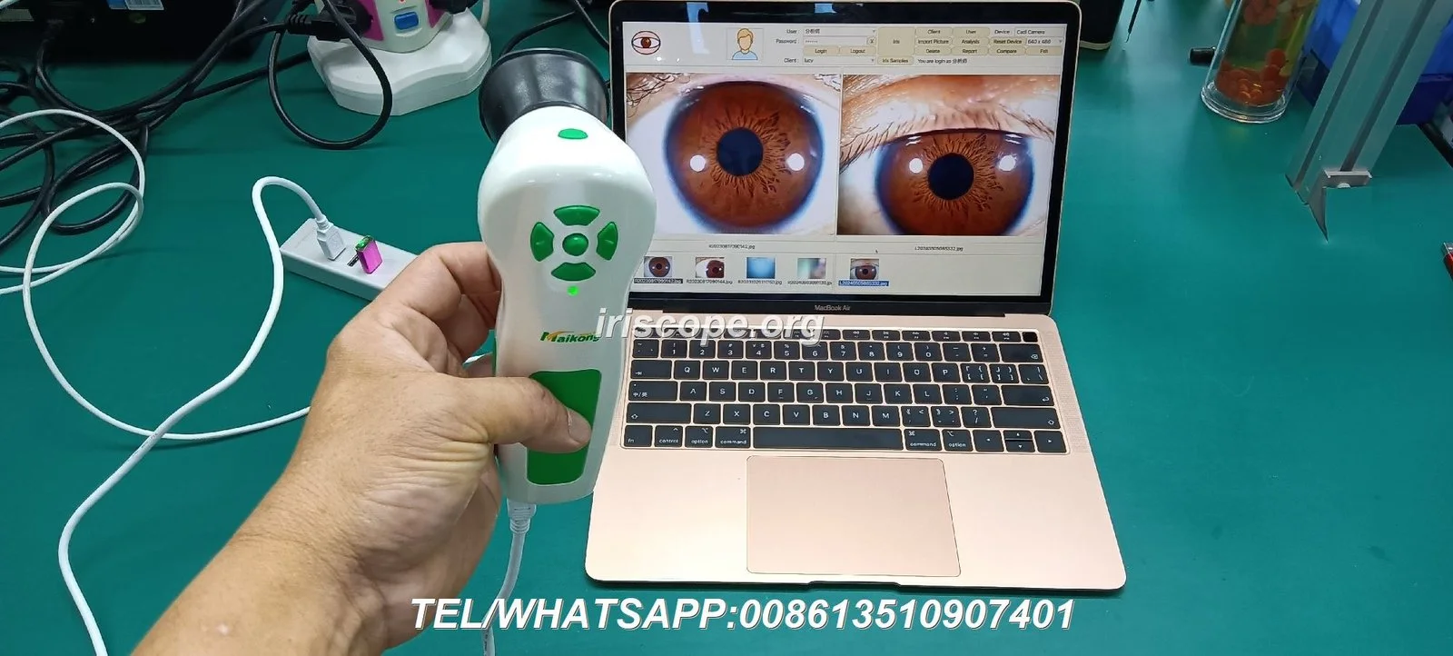 Opciones y alcance de personalización OEM/ODM para distribuidores MAIKONG en España — maikong iridology camera iriscope 12 mp for apple mac os (32).JPG